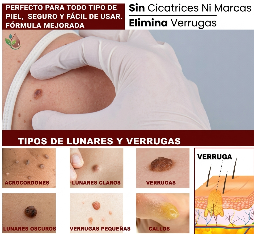 Crema antiverrugas Ister
